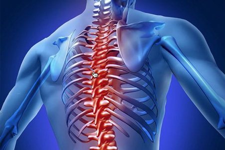 Các cơn đau cơ xương khớp ở lưng kéo dài có thể gây ra tình trạng liệt nửa người